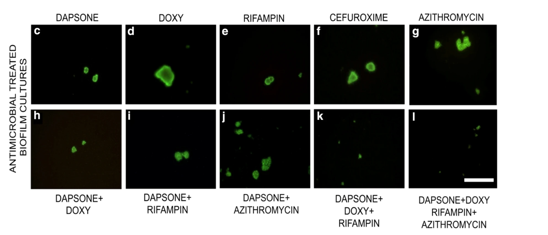 Werking dapson op de biofilm